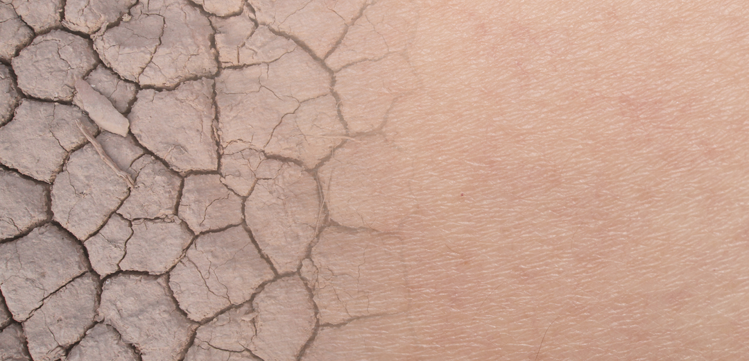 Image of dry skin morphing into moisturized skin
